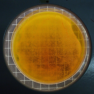 Xylose lysine agar base